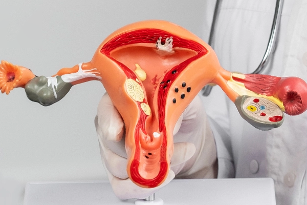 Illustration of the uterus and ovaries